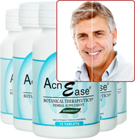 Rosacea Symptoms Treatment