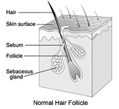 Normal Hair Follicle