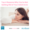 Top 4 Reasons Why You Aren’t Getting Rid of Your Adult Acne