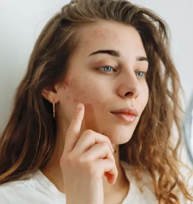 24  Question and Answers Essential To Understand the Causes 