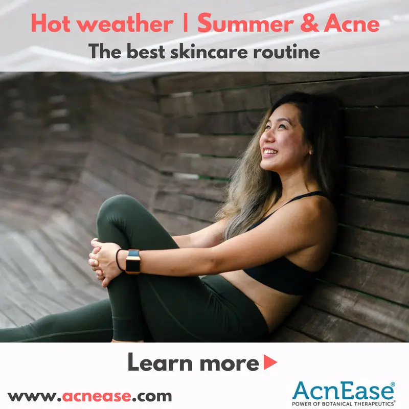 The best skincare routine in hot weather | summer for acne-prone skin ...