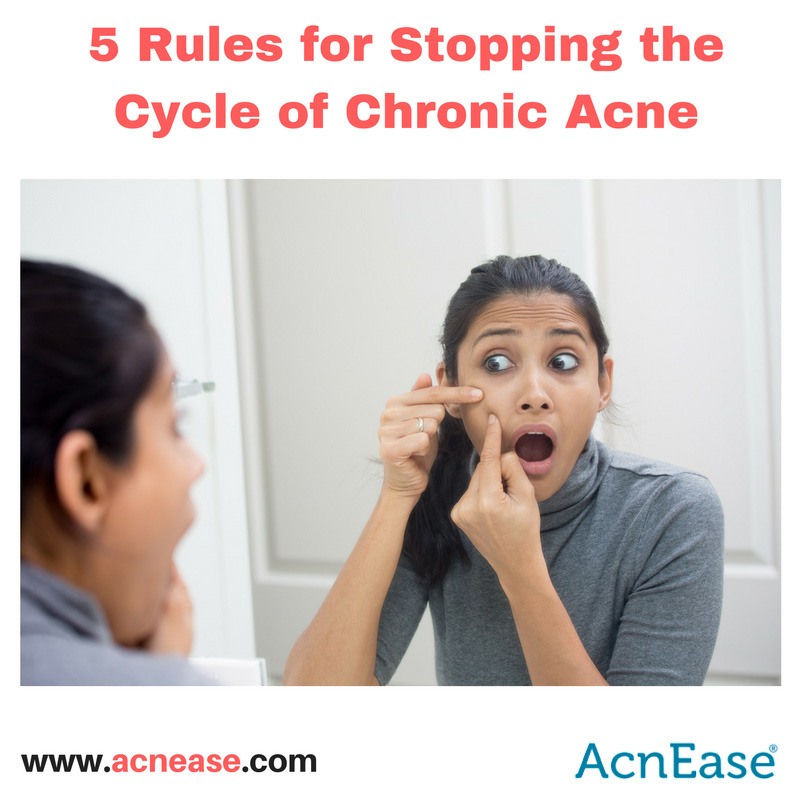 A Look At Chronic Acne, And 5 Rules For Stopping The Cycle
