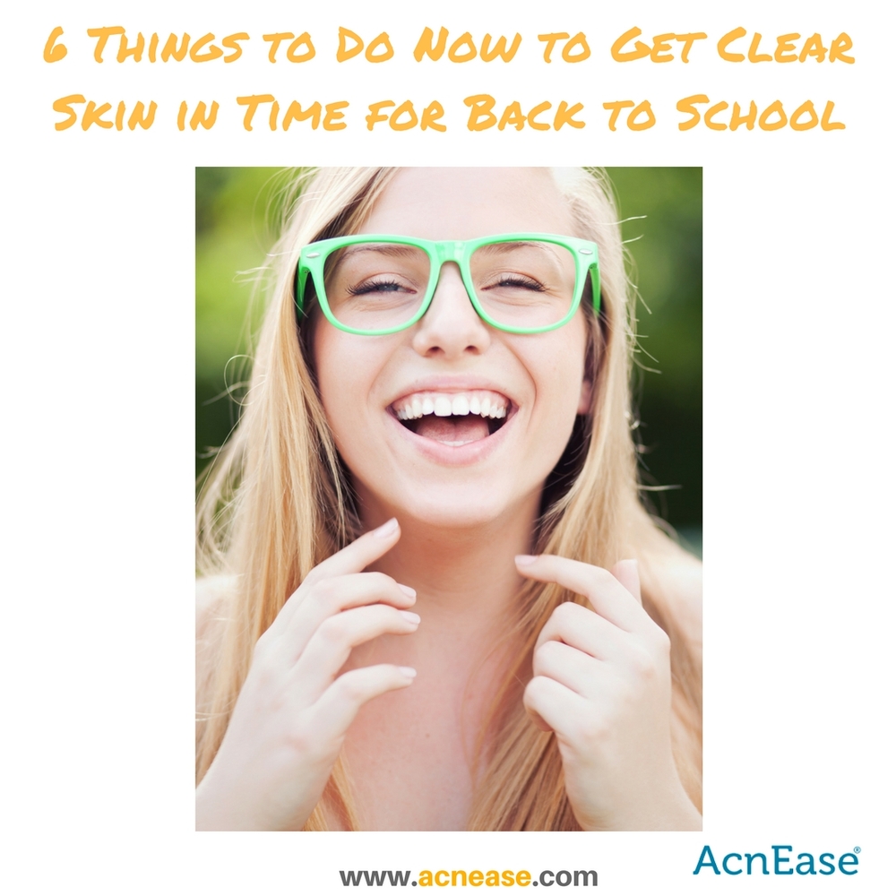 6 Things To Do Now To Get Clear Skin In Time For Back To School