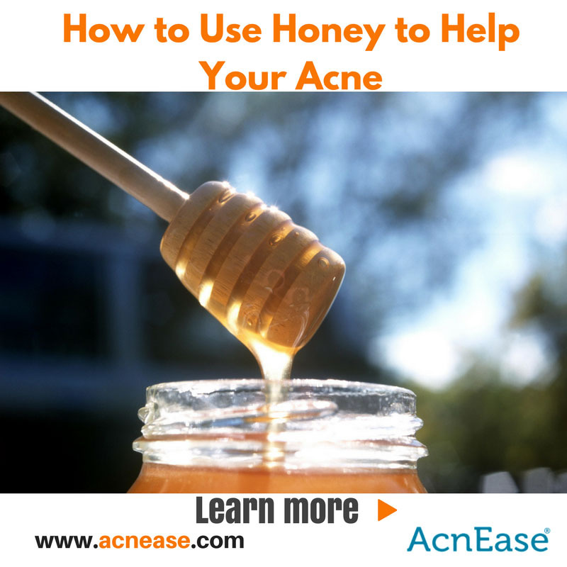 The Benefits of Using Honey to Help Your Acne, From the Inside, Out!