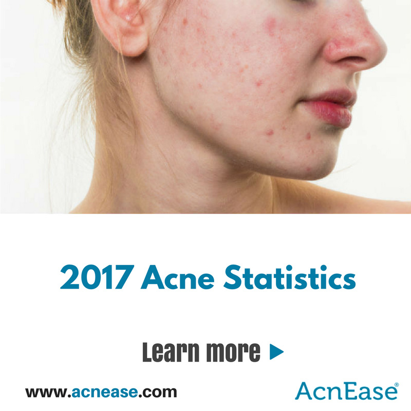 The Facts Behind The Acne Statistics 2017