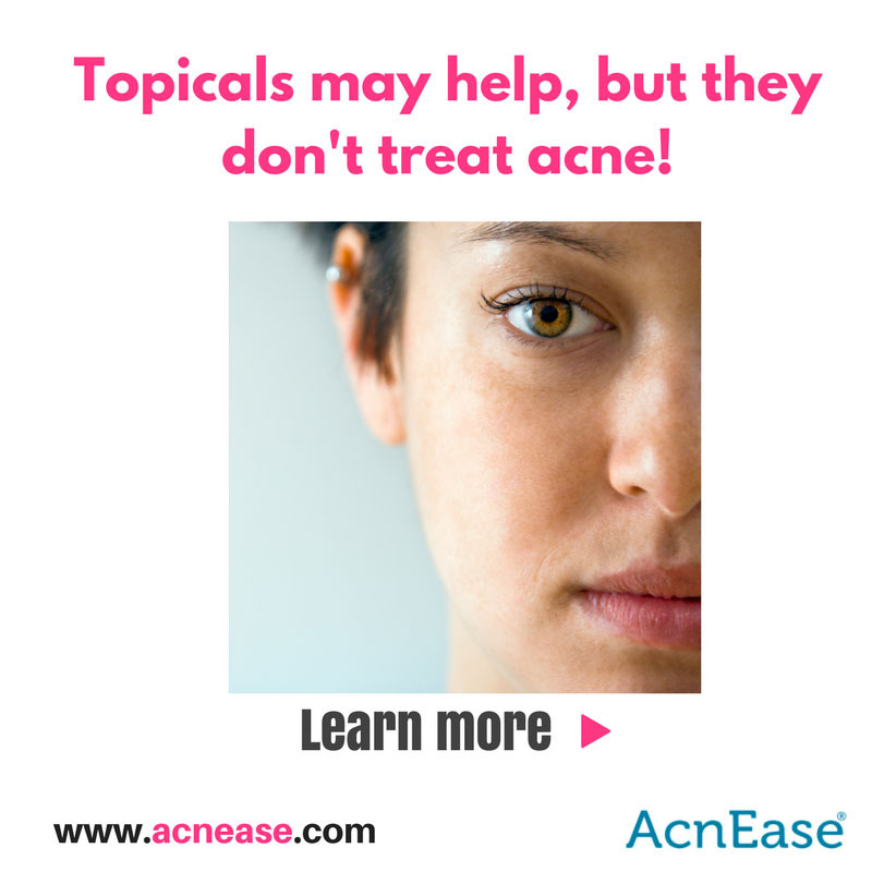 Why Topicals Alone Will Never Get Rid of Your Acne