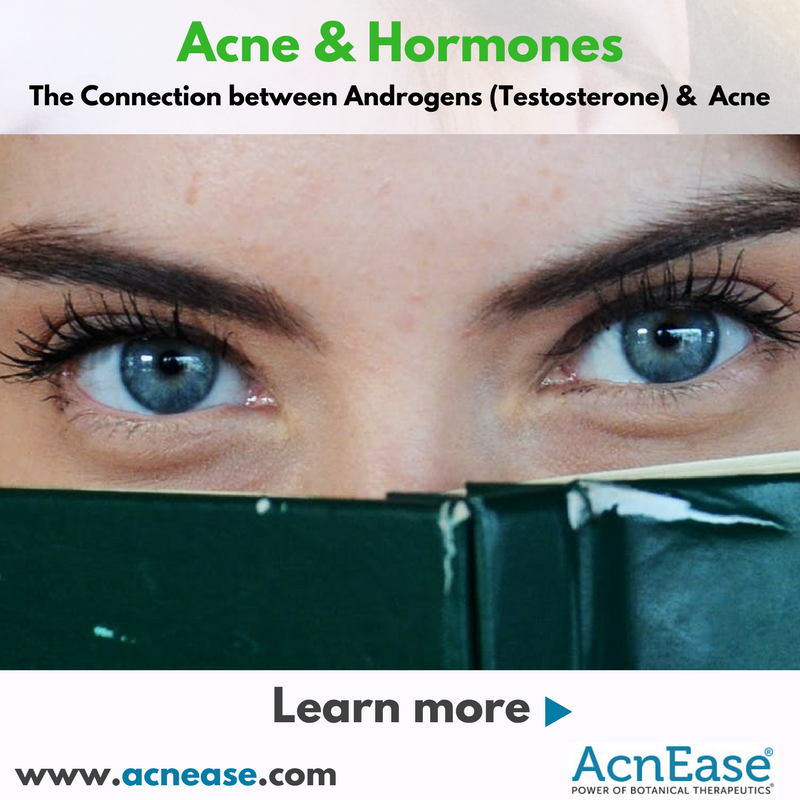 What is a Connection about Androgens (Testosterone) & Acne