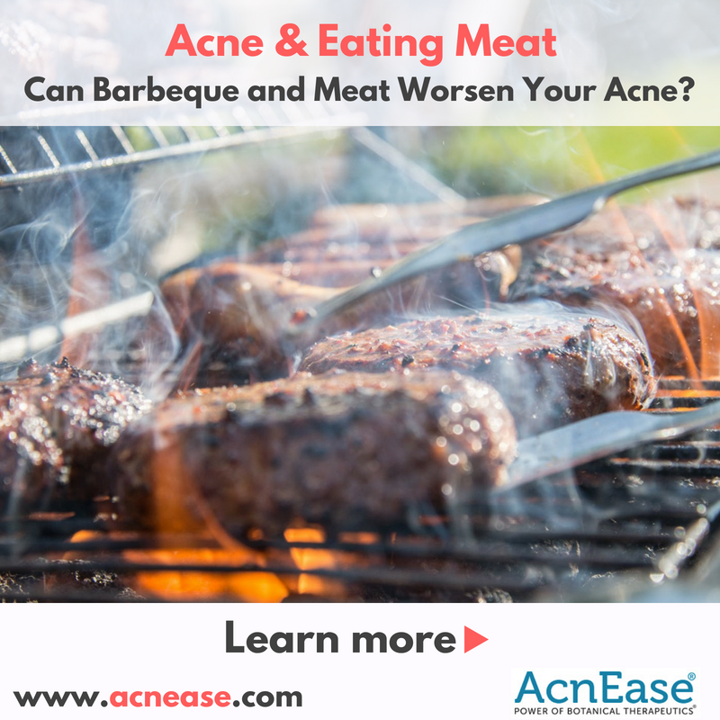Can Barbeque and Meat Worsen Your Acne?