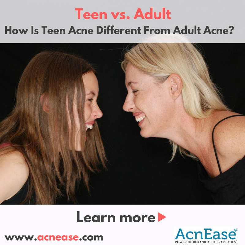 How Is Teen Acne Different From Adult Acne?