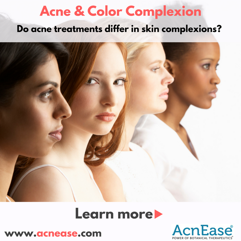 Is acne treatment different for different color complexion?