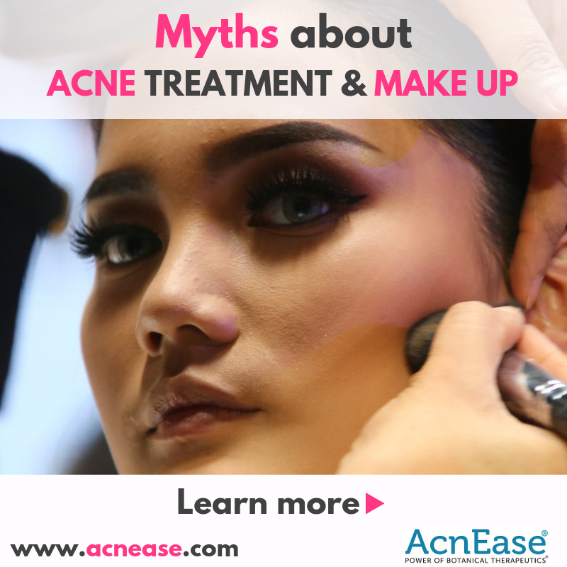 Myths about acne treatment and make up