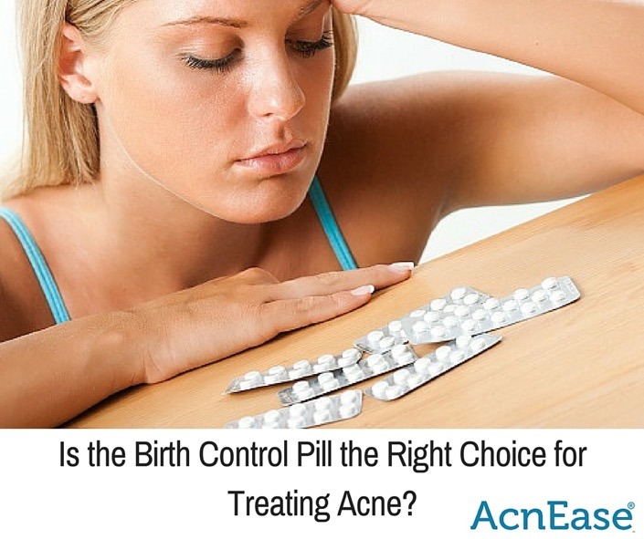 Is Birth Control Pill the Right Choice for Treating Acne?