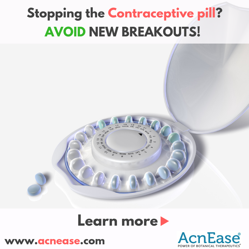 I want to stop taking the contraceptive pill, will AcnEase help to decrease new acne breakouts? 