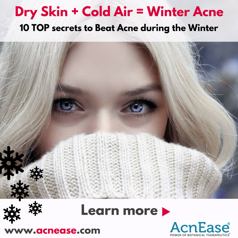 Dry Skin + Cold Air = Winter Acne