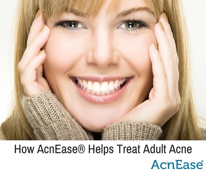 How AcnEase® Helps Treat Adult Acne
