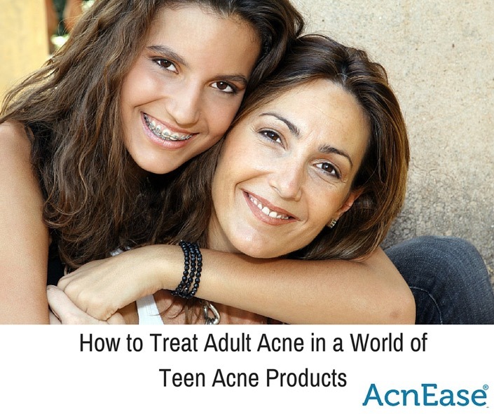 How to Treat Acne in a World Full of Teen Acne Products