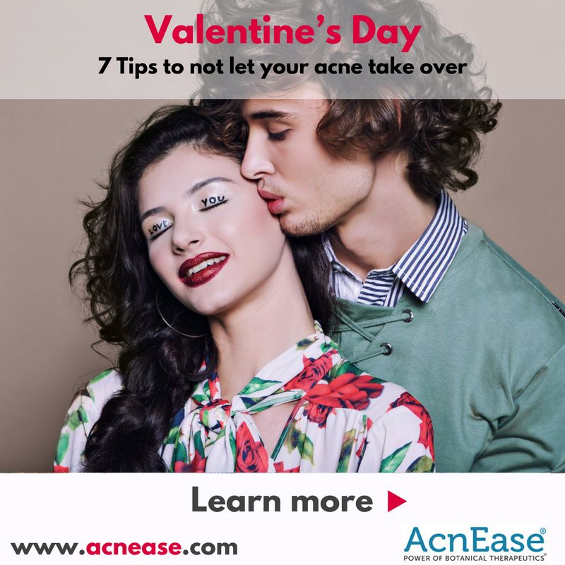 7 Tips to not let your acne take over your Valentine’s Day