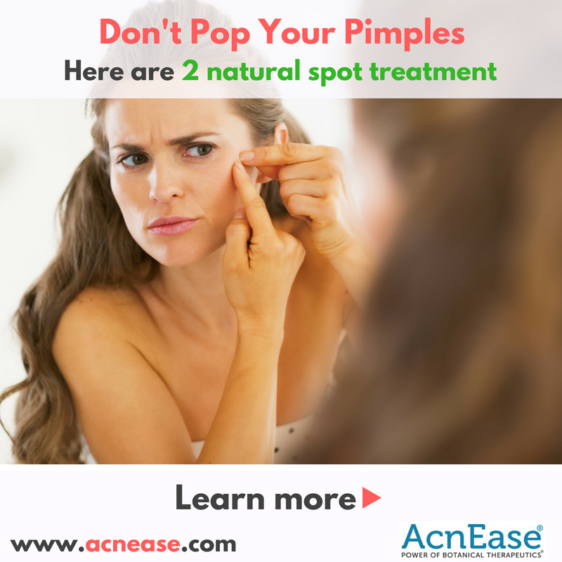Don't Pop Your Pimples, here are 2 natural spot treatment