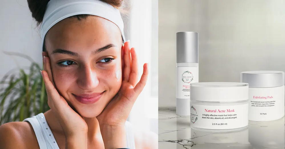 What Can I Do About My Acne Scars?