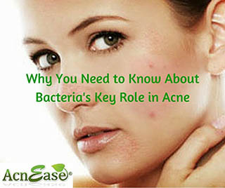 Why You Need to Know About Bacteria’s Key Role in Acne
