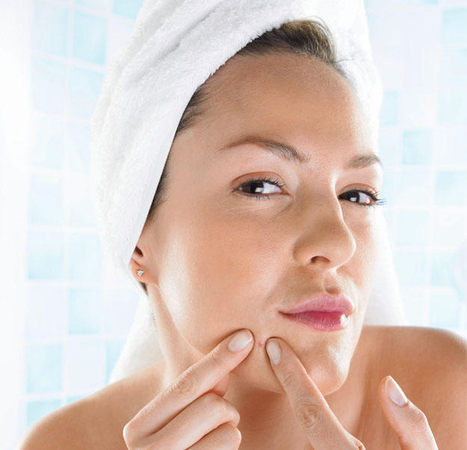 7 Easy Tips for Decreasing Acne Breakouts | Blog 7 Easy Tips for Decreasing Acne Breakouts | Blog
