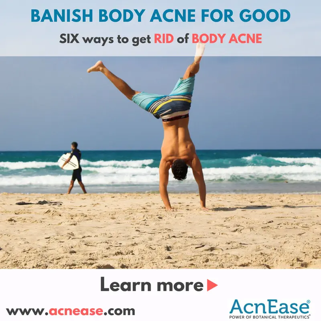 Banish Body Acne for Good