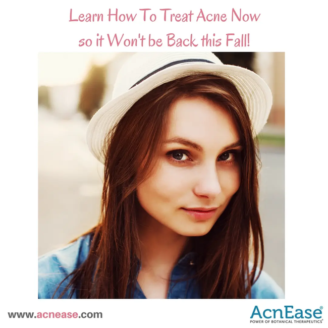 How to Treat Acne Now So That it Won’t be Back This Fall