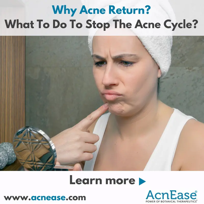 Why Acne Return and What To Do To Stop The Acne Cycle