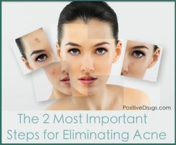 The 2 Most Important Steps for Eliminating Acne Scars