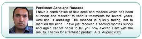 Rosacea treatment testimonial